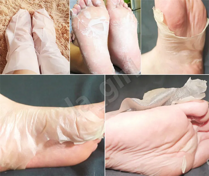 Peeling pour les pieds